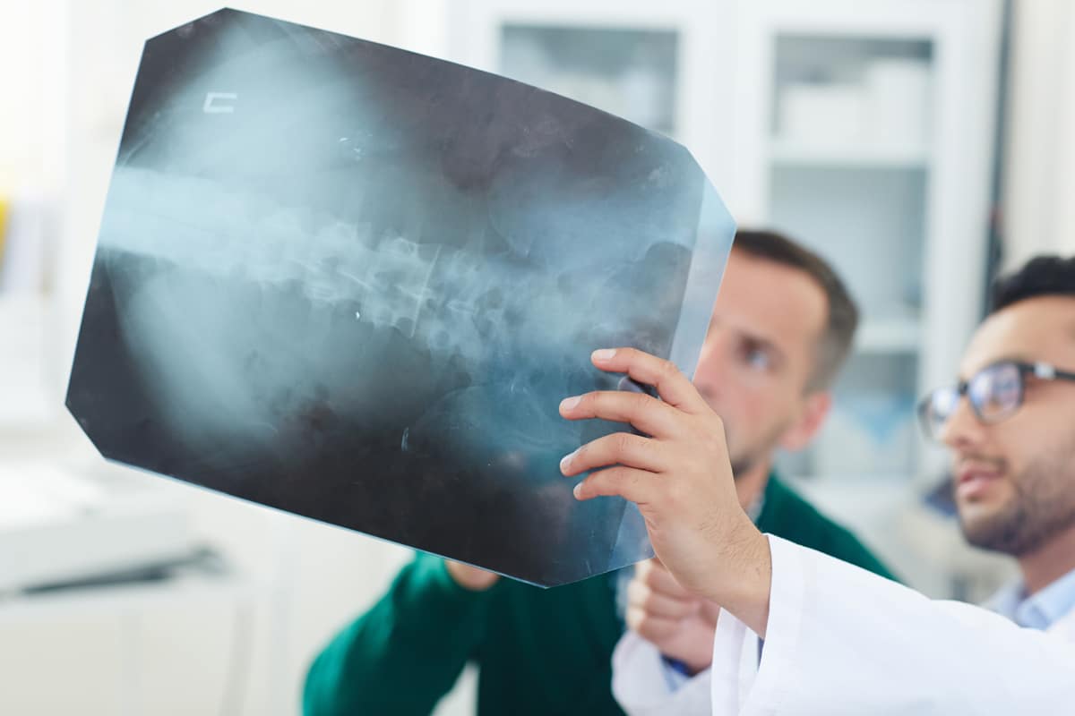 Fargo Spinal Cord Injury Attorney
