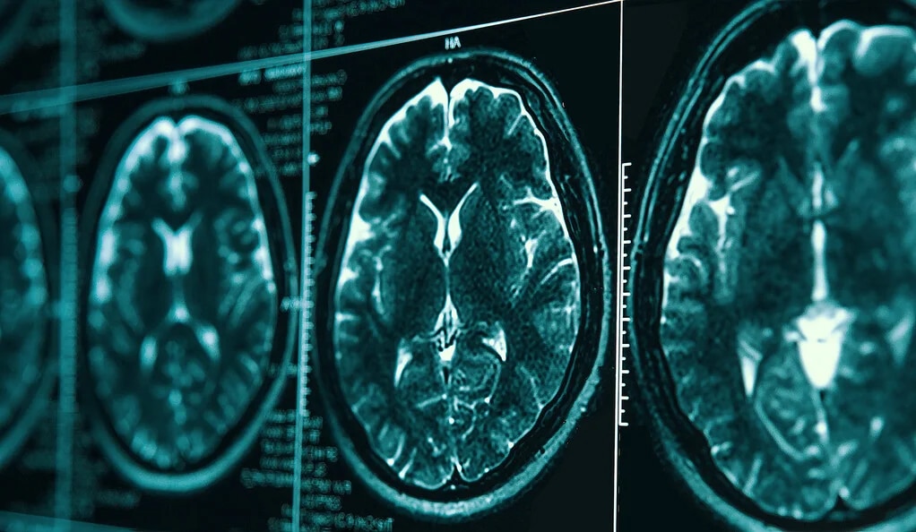 Traumatic brain injuries (TBI)