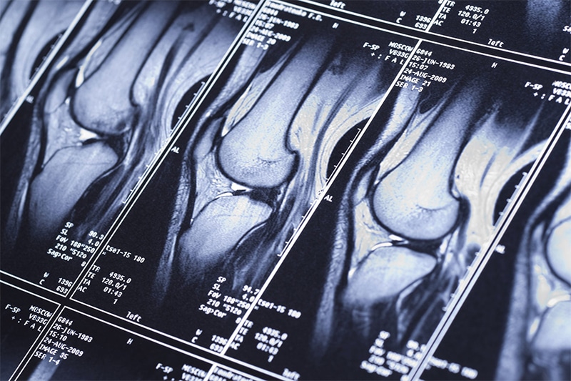 What to Do After Your Injury