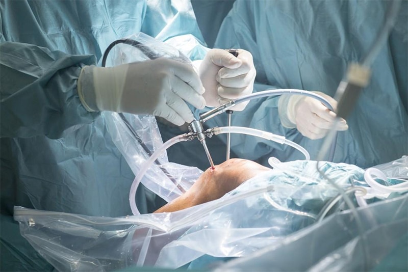 Treating a Knee Injury