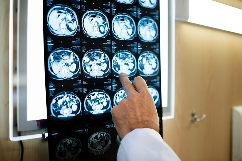 Train Accident injury examined on imaging