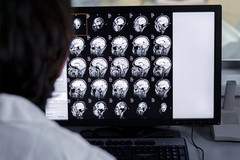 Traumatic Brain Injuries