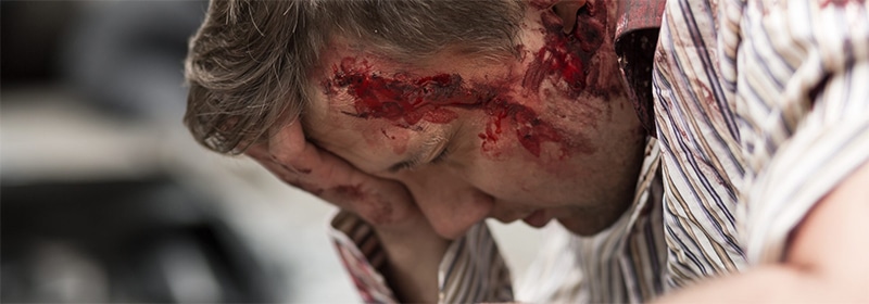 What are the Common Injuries in Rear-End Accidents? Albuquerque