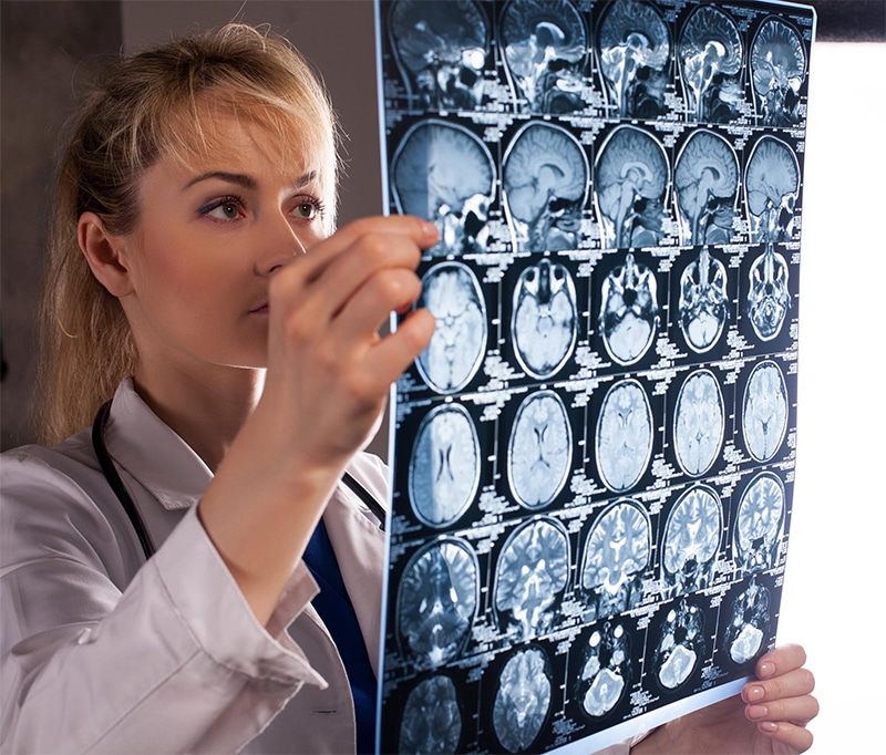 Common Car Accident Injuries