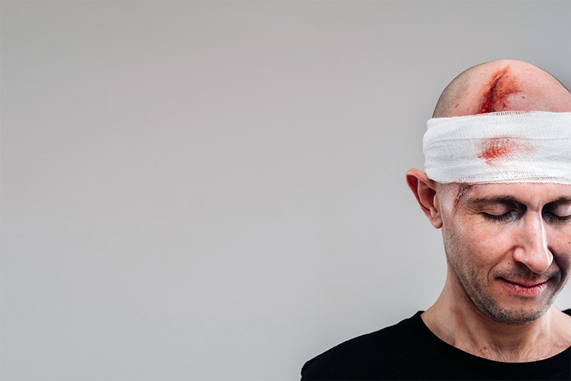 What is a Head Injury?