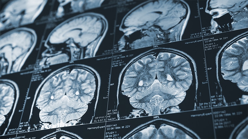 What is a Head Injury?