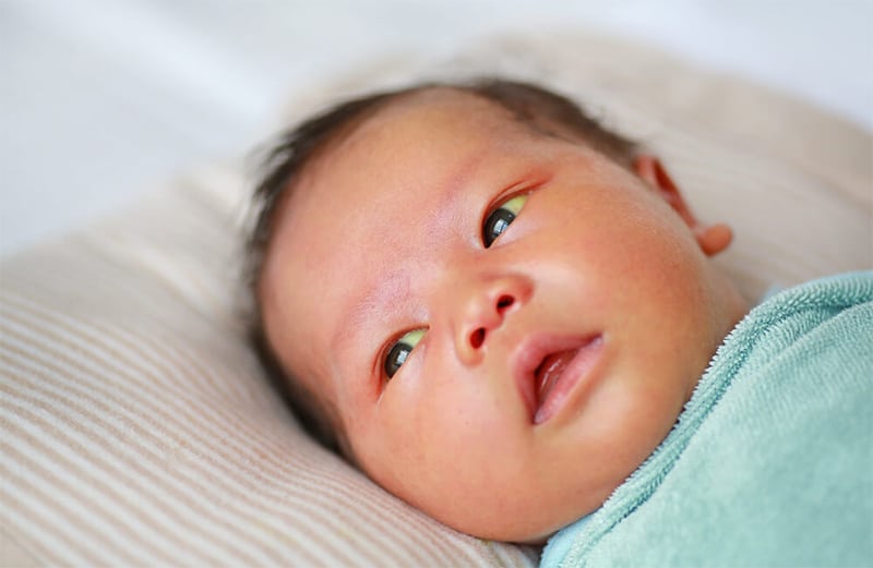Signs of Birth Injuries