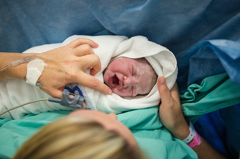 Common Types of Birth Injuries