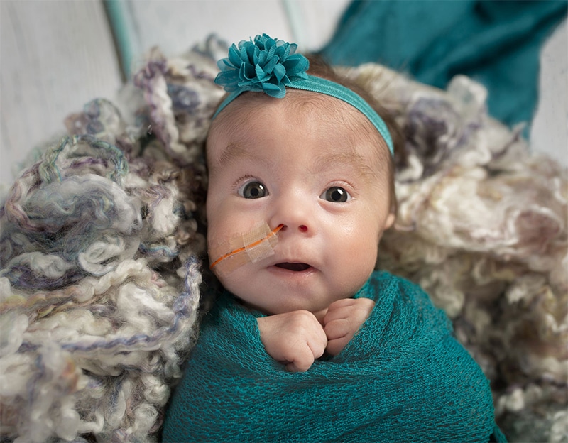 Causes of Birth Injuries