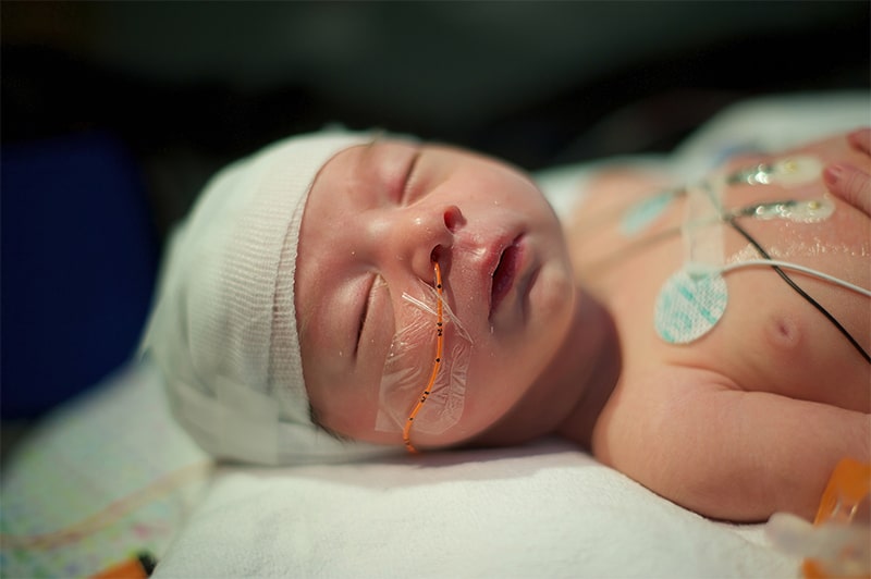 Common Causes of Wrongful Birth in Portland, Oregon