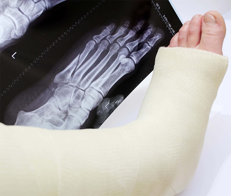Causes of Foot Injury