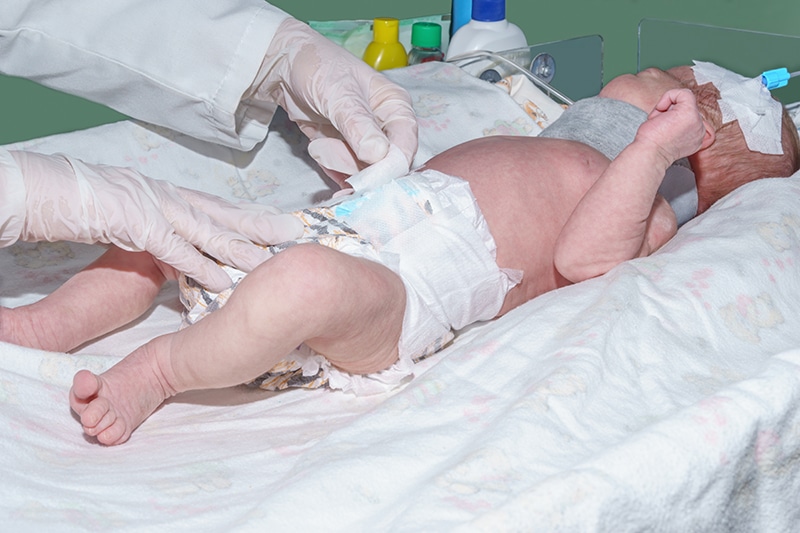 What is a Birth Injury?