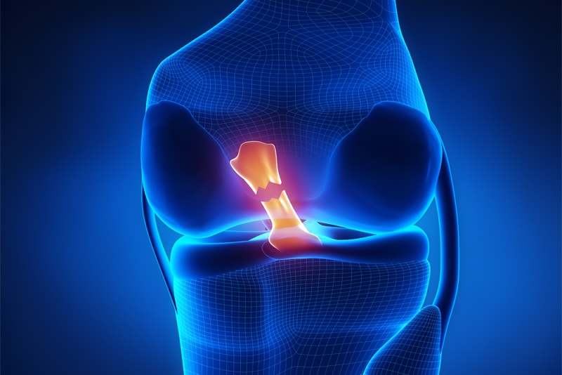 Typical Injuries in Eugene Knee Injury Cases