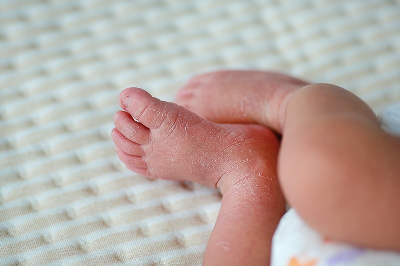 Eugene Birth Injury Lawyers