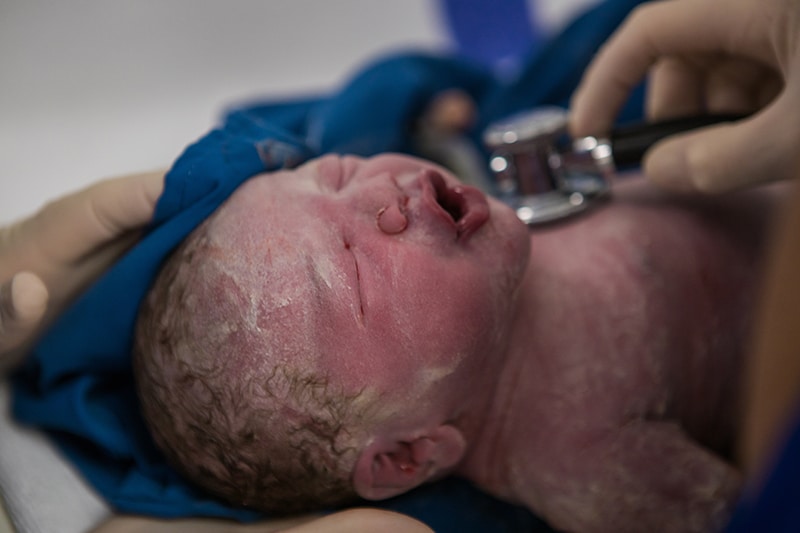 Potential Medical Negligence During Birth in Eugene