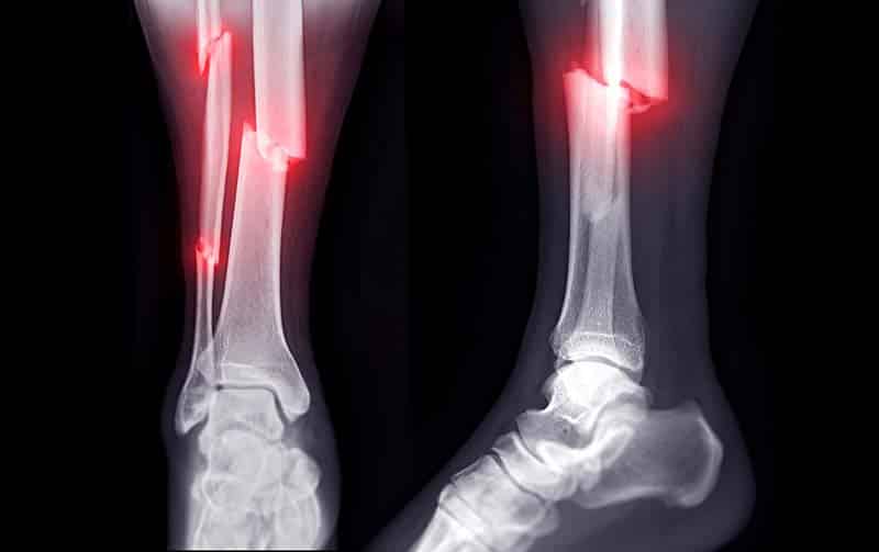 Understanding the Types and Causes