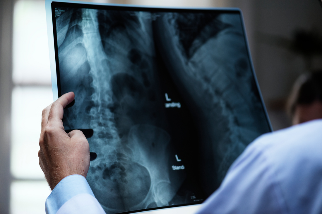 Spinal Cord Injury Attorney