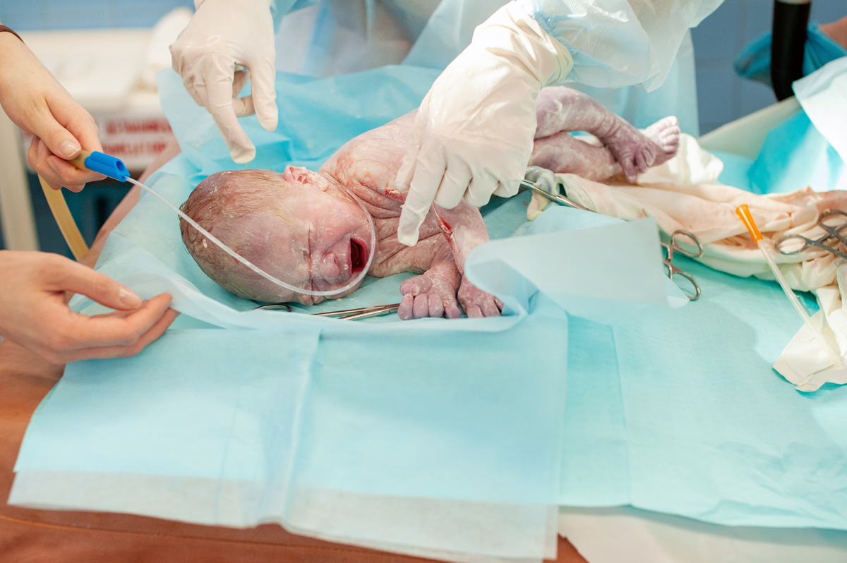 Determining Liability for a Birth Injury Claim