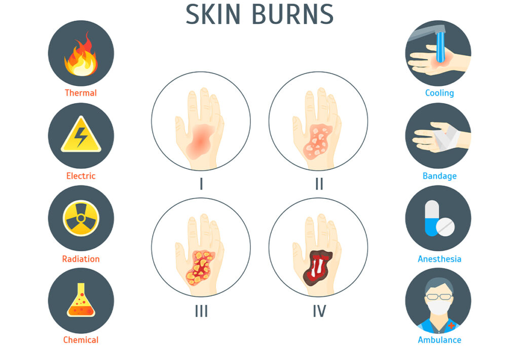 Types of Skin Burns