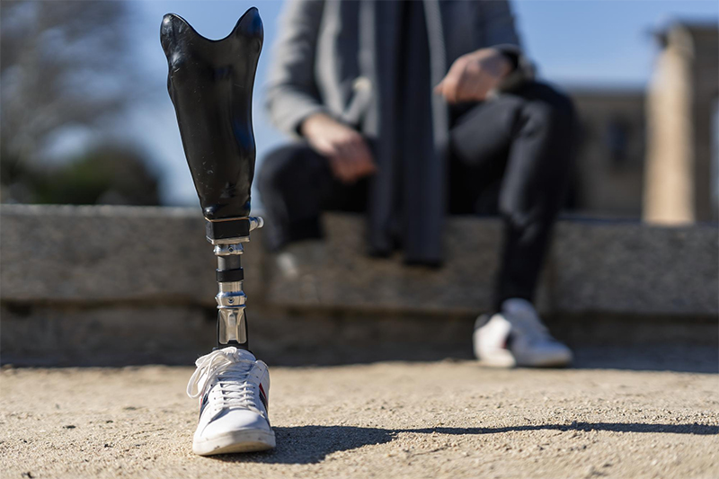 Common Injuries of Workers' Compensation Accidents in Orlando