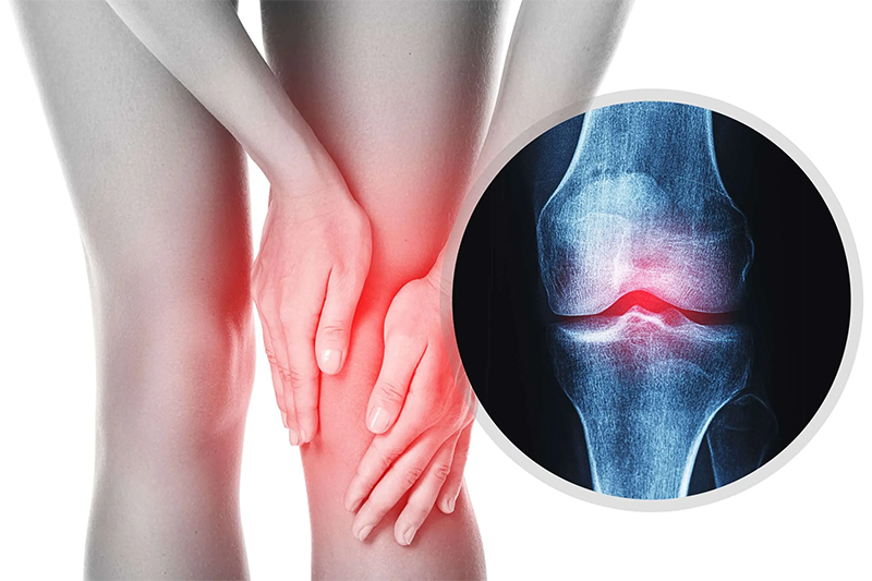 How Do Knee Injuries Happen?