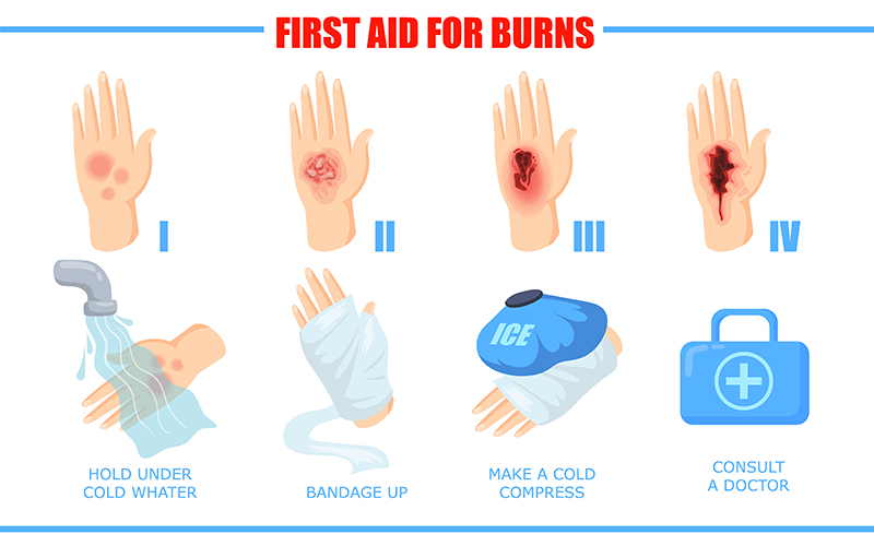 Categories of Burn Injuries