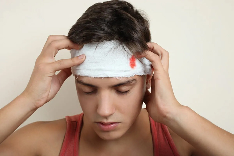 What is a Head Injury?