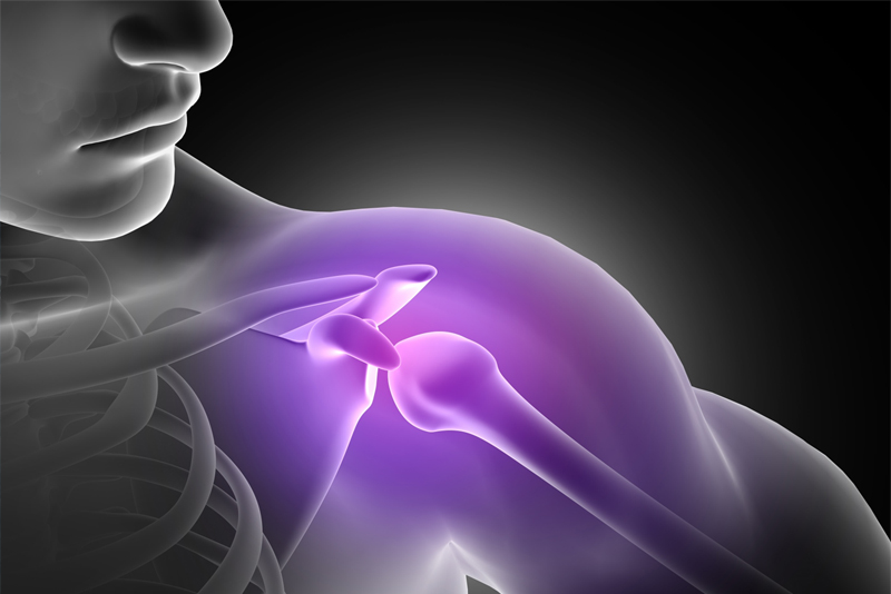 Common Types of Shoulder Injuries