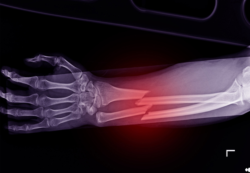 What is Wrist or Hand Injury?