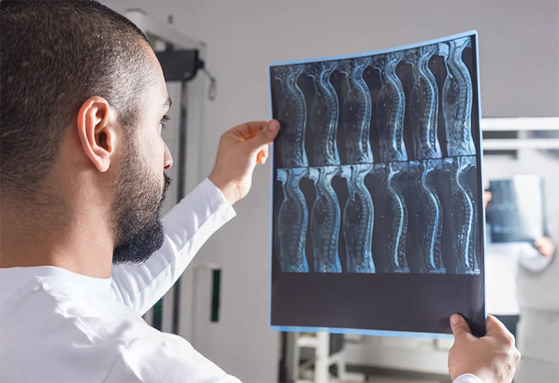 What is a Spinal Cord Injury? Los Angeles