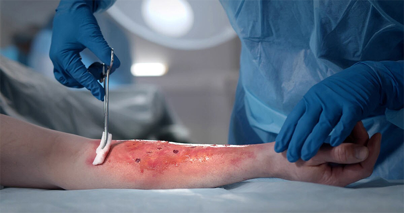 Common Injuries of Plant Accidents in Fresno, California