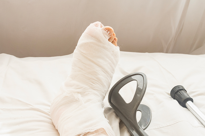 Common Slip and Fall Injuries in Lake Oswego