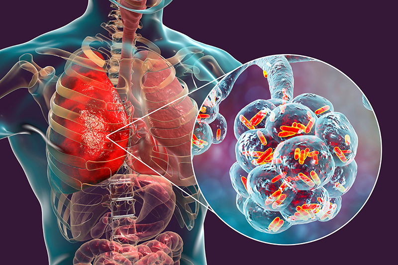 Types of Hospital-Acquired Infections in Fresno